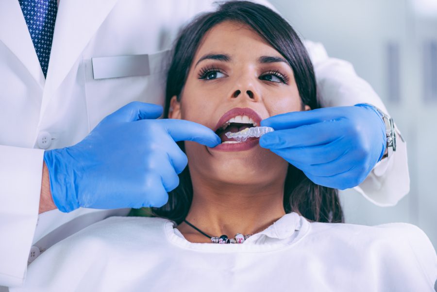 postavljanje folija na zube - stomatolog postavlja invisalign folije - devojka kod stomatologa