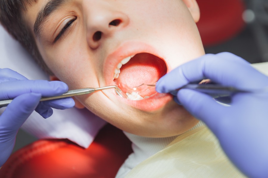 popravka zuba kod deteta