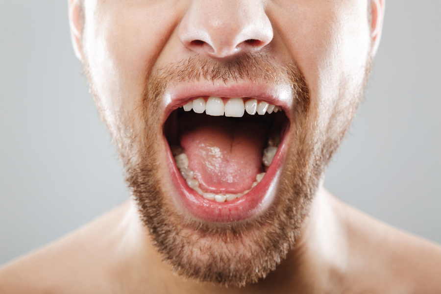 prikaz odraslog coveka otvorenih usta kojem fali donja sestica