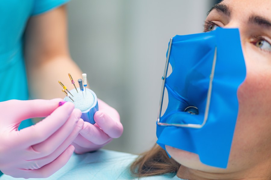 prikaz pacijenta i stomatologa sa iglicama za čišćenje kanala zuba tj. vađenje živca